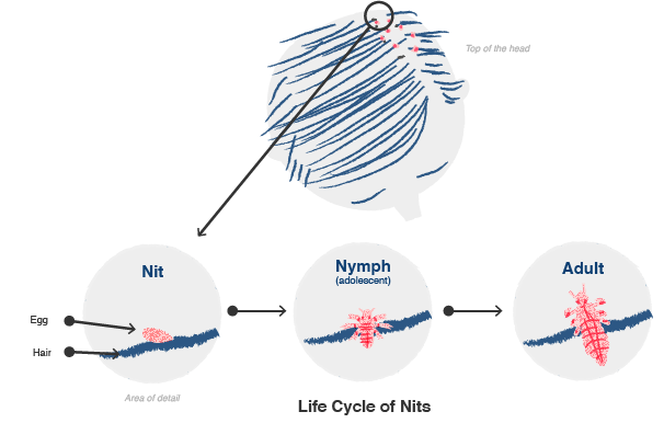 Illustration of the life cycle of nits (lice)