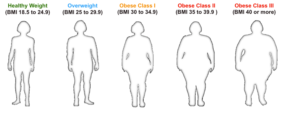 Obesity Who Is Affected PublicHealth Obesity Who Is Affected PublicHealth