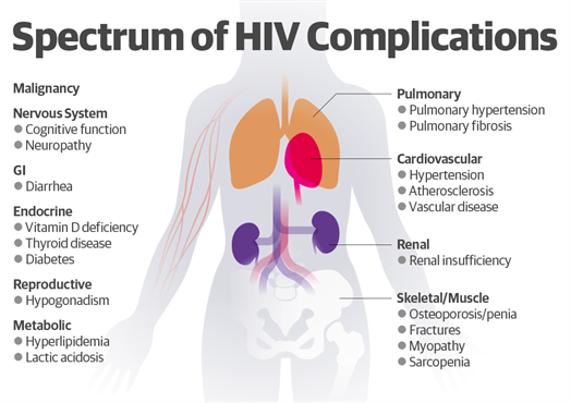 HIV AIDS PublicHealth