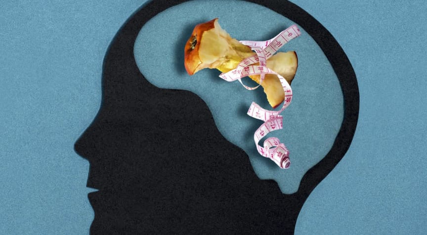 Understanding Eating Disorders in College