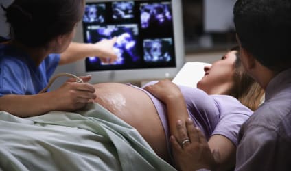 Card Thumbnail - Best Diagnostic Medical Sonography Programs