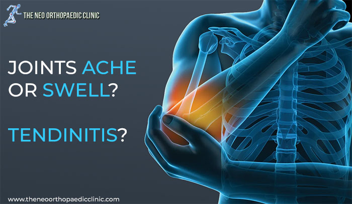 Signs of tendonitis and how to cure it