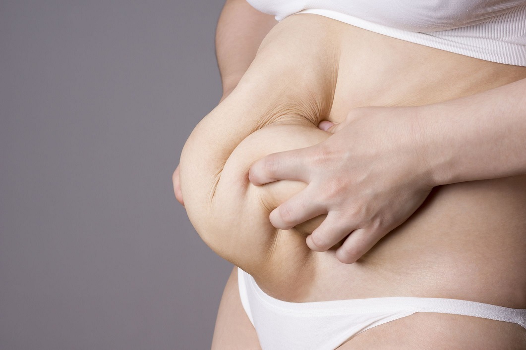 TUMMY TUCK INTERVENTION AFTER PREGNANCY