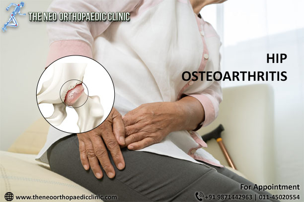 Understand how to treat osteoarthritis and live without pain