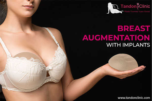 BREAST AUGMENTATION WITH BREAST IMPLANTS
