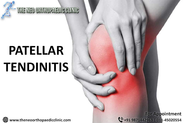 Patellar Tendinitis