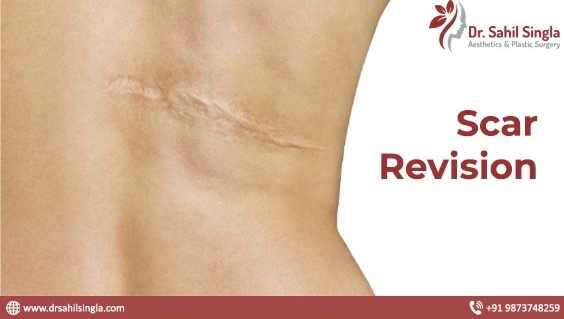 Do you know how scar revision surgery works?