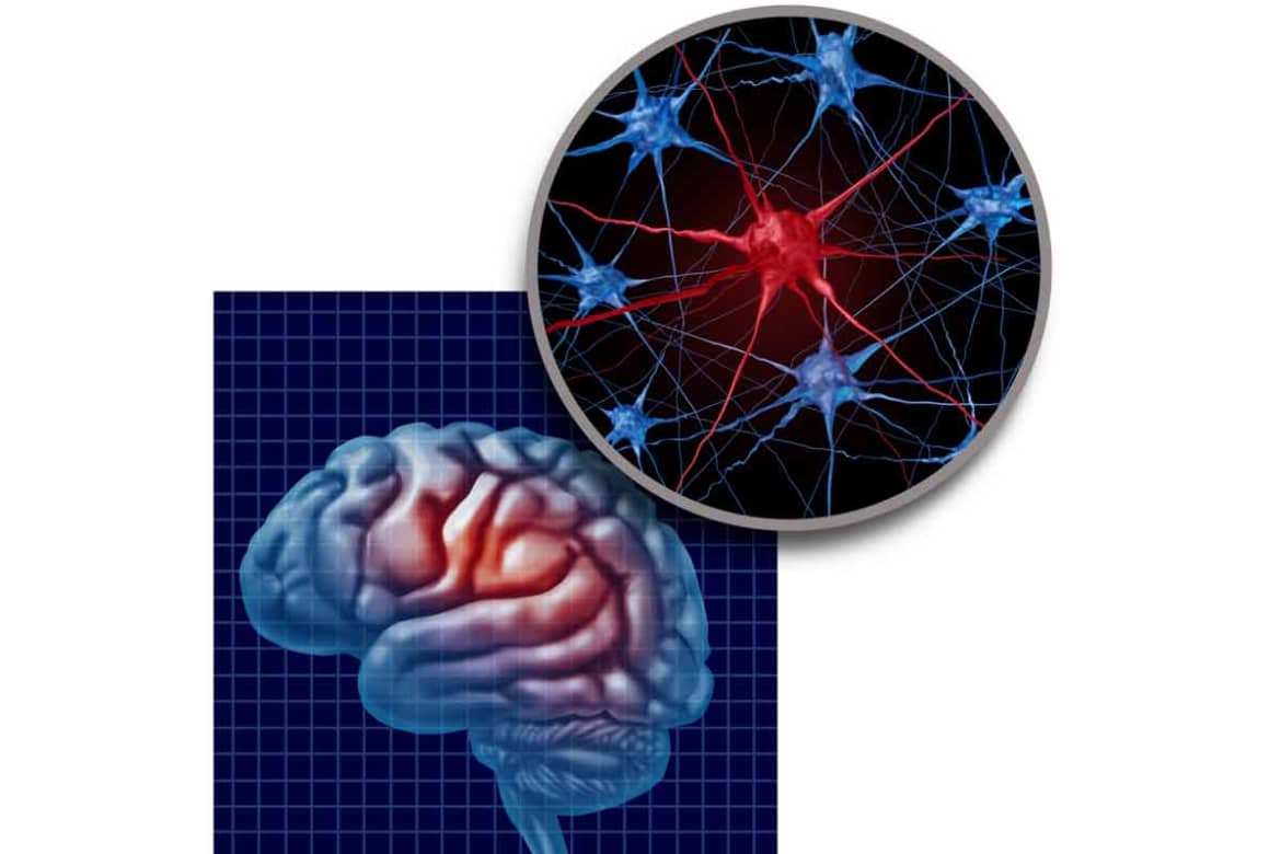 Being such a potent stimulant, methamphetamine has a direct effect on the brain, and therefore on psychological and mental health. Psychological Effects of Methamphetamine Use