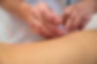 Benefits of acupuncture 