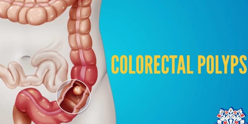 psychological causes of colon polyp