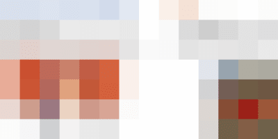 hemorrhoids symptoms