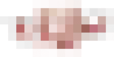 intestinal inflammation symptoms