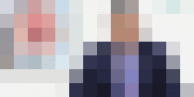 external hemorrhoids