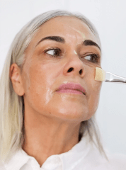 Non-Surgical Face Lift