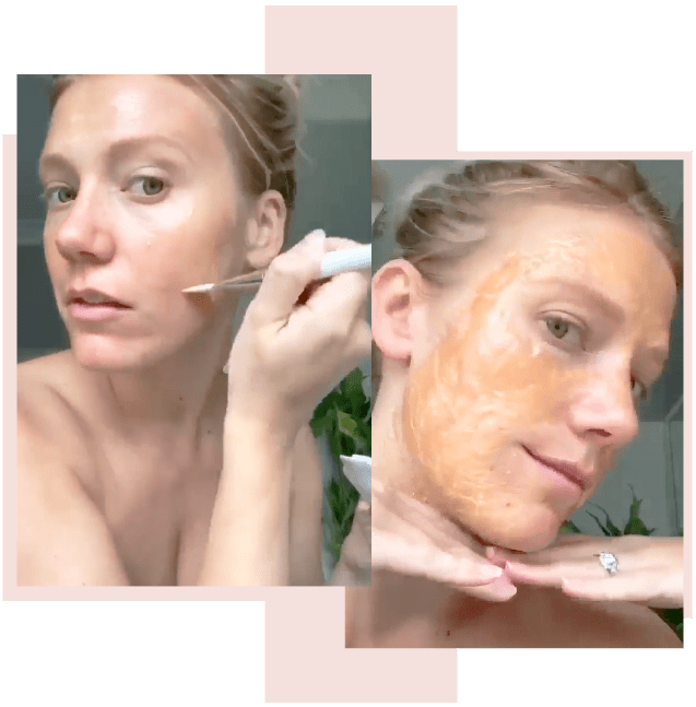 Non-Surgical Face Lift Kit
