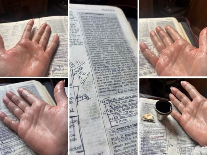 photos of oil on hands supplied by author