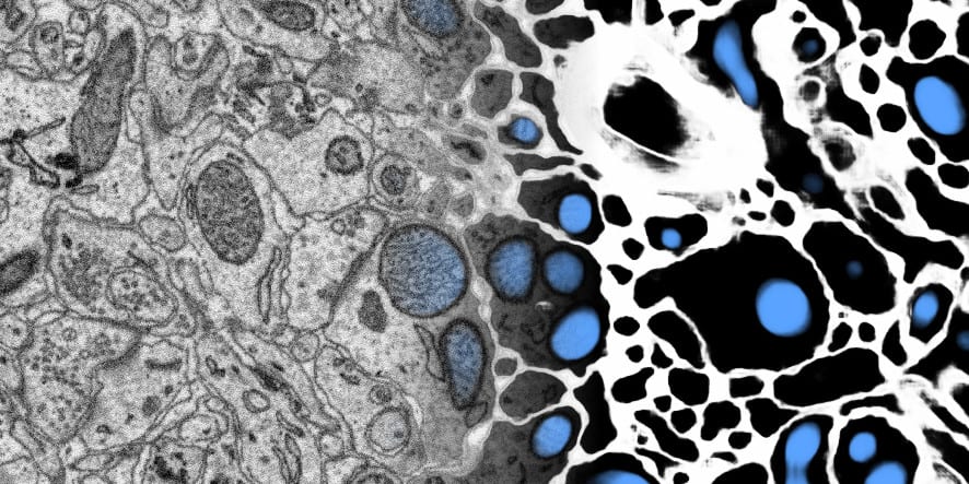 Example visualisation of ELEKTRONN2's usage on a 3D SBEM data set
(blending input to output from left to
right).