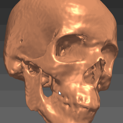 Closing holes in skull