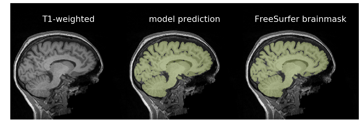 Model's prediction of brain mask