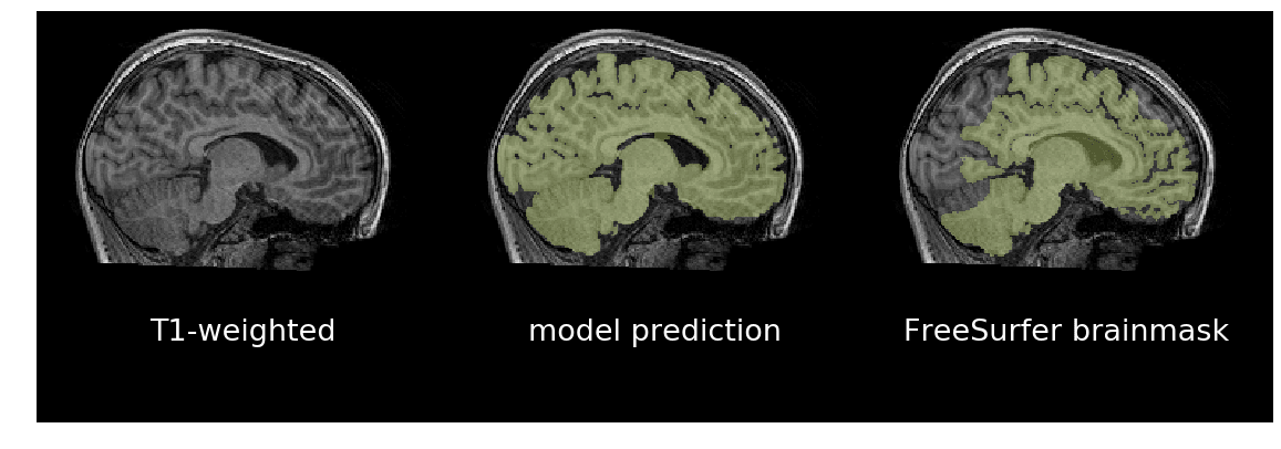 Model's prediction of brain mask