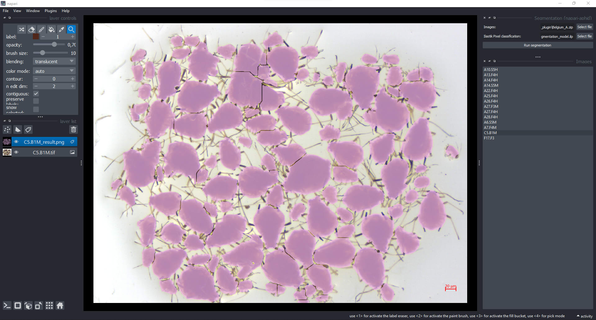 segmentation_cpe