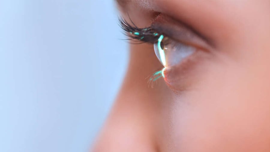 A photo of OCLI Vision