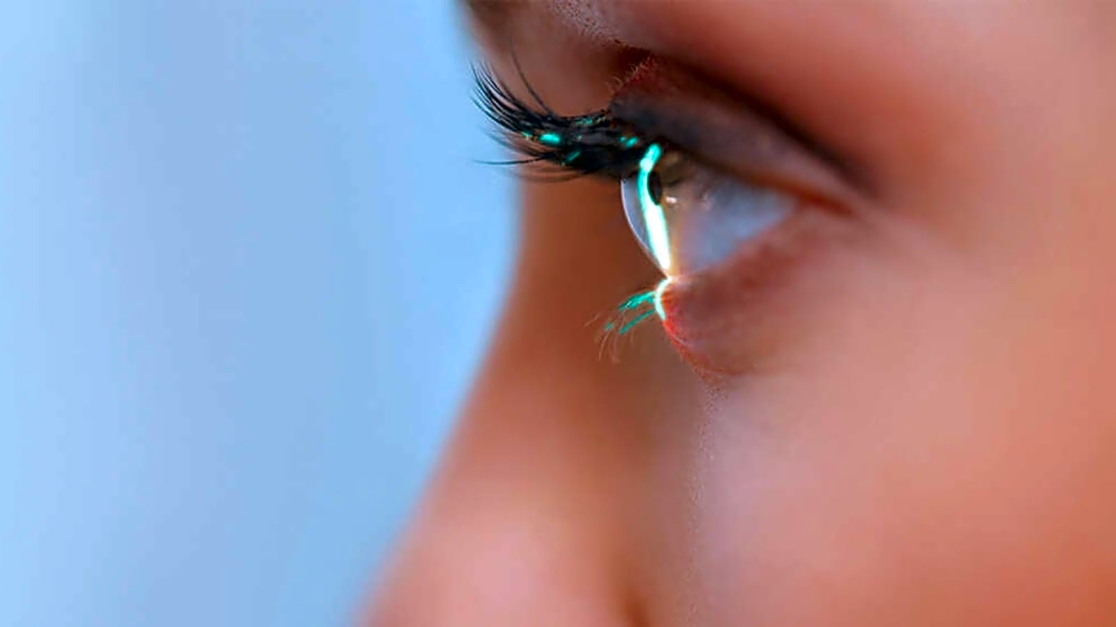 OCLI Vision photo