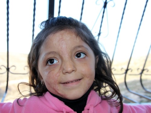 Un nouveau visage pour Habiba et Leyane