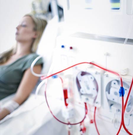 woman receiving a dialysis treatment