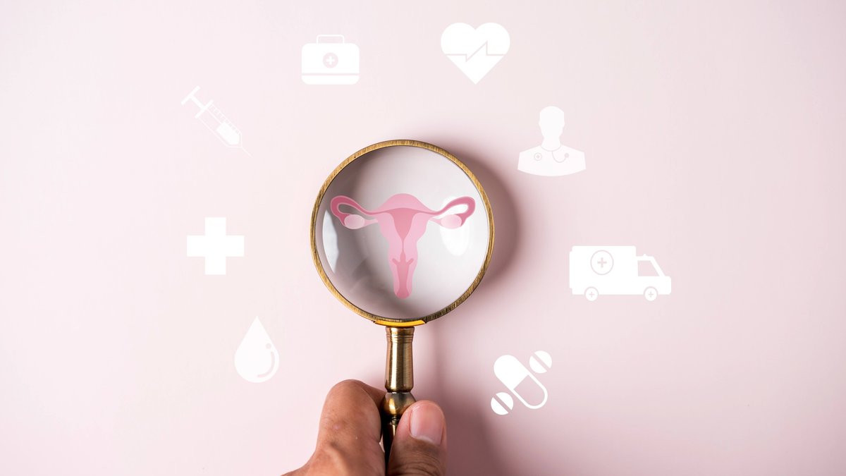 Mayo Clinic Identifies Overlooked Ovarian Cancer Signs in Women - ovarian cancer signs