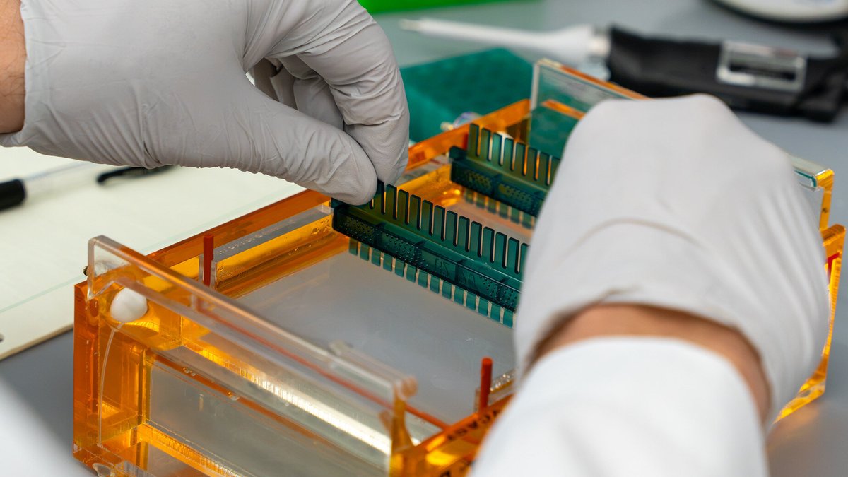 Gene linked to fat storage may raise anorexia risk - gene linked to anorexia risk