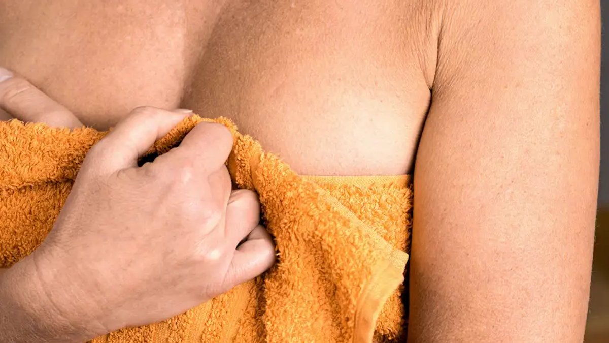 Most breast bruises not linked to cancer - breast cancer