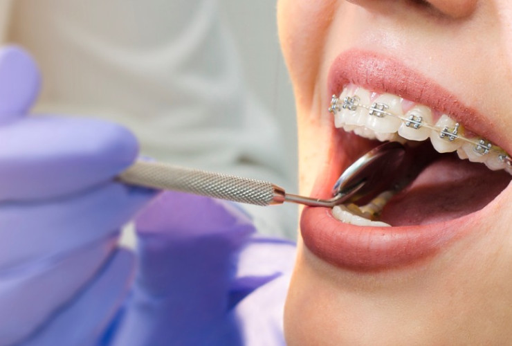 How to become an orthodontist ‐ CareerExplorer