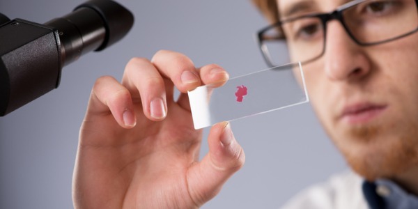 A cytologist looking at a glass slide in order to examine a tissue sample.