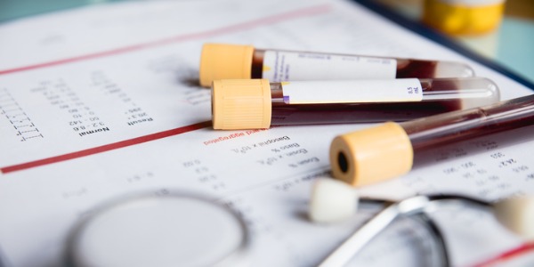 Three vials of blood taken for testing.