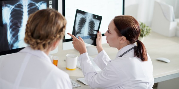 Two pulmonologists looking at X-rays.