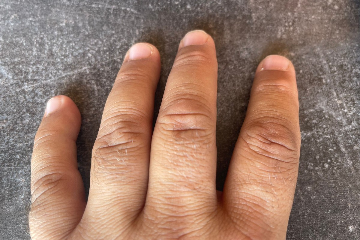 Grausiger Fund in Birsfelden BL - Fund eines einzelnen Fingers hinter einem Restaurant!