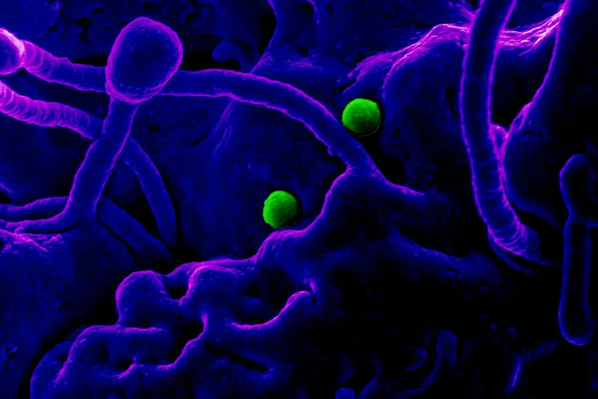 Coronavirus - 800 bestätigte Fälle in Österreich