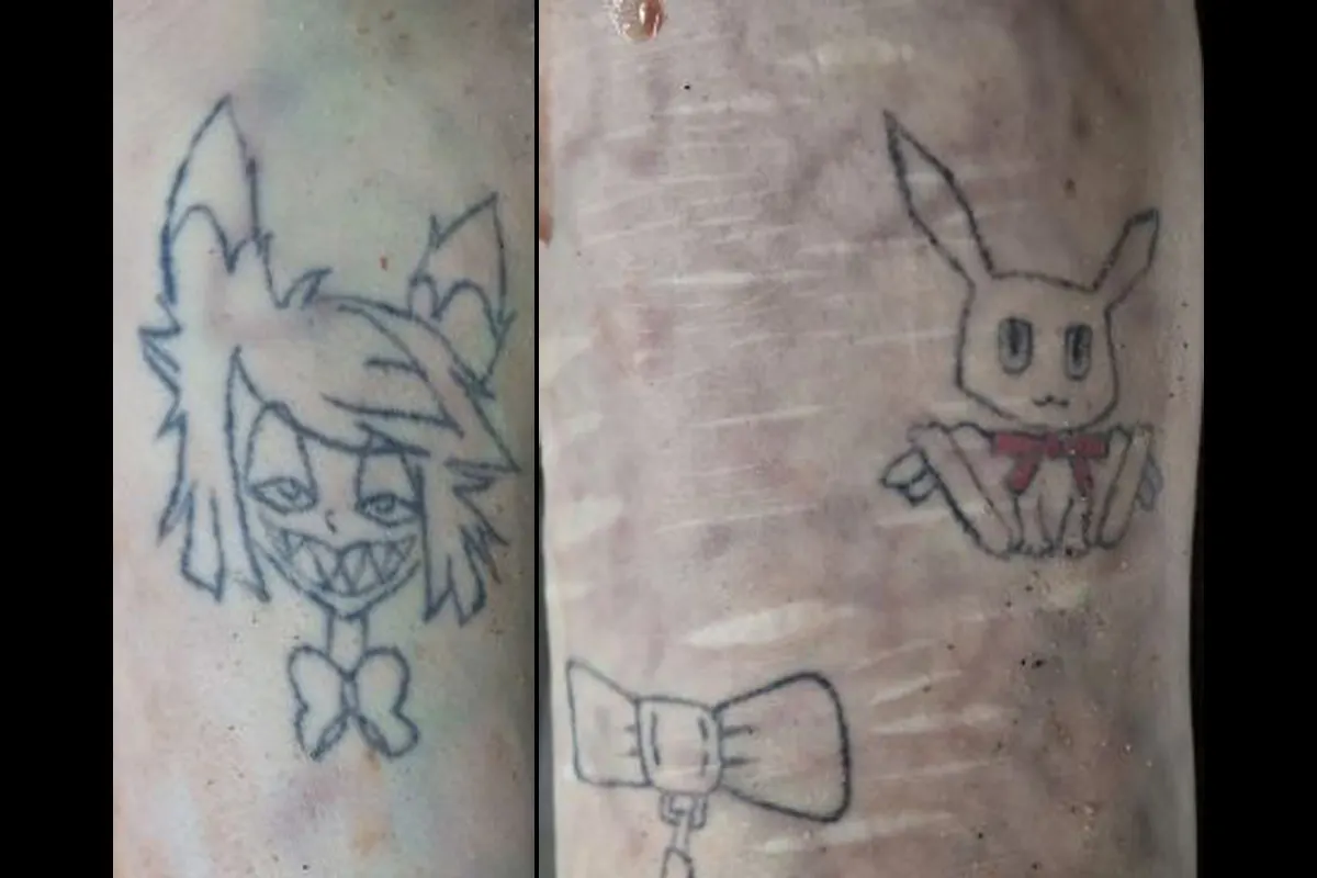 Zwei Tätowierungen auf der Haut, links eine grinsende Comicfigur mit Schleife, rechts eine Tierfigur mit roter Schleife.