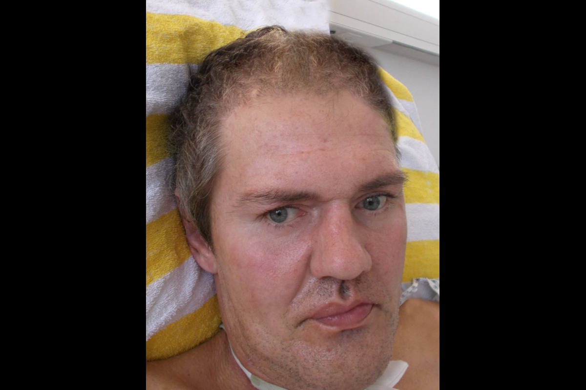 Unbekannter Hilfloser aus Charlottenburg-Wilmersdorf – Polizei bittet um Mithilfe