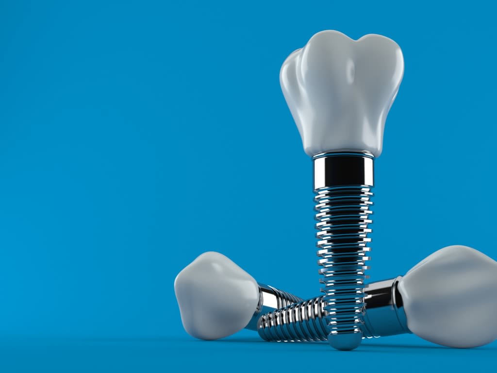 implants dentaires sur fond bleu