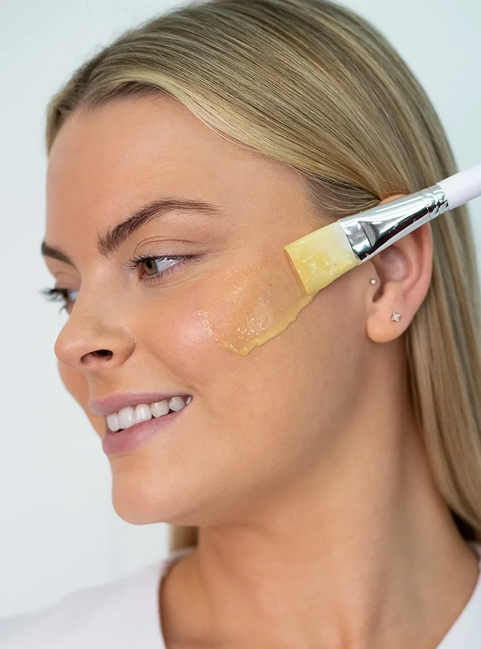 Non-Surgical Face Lift