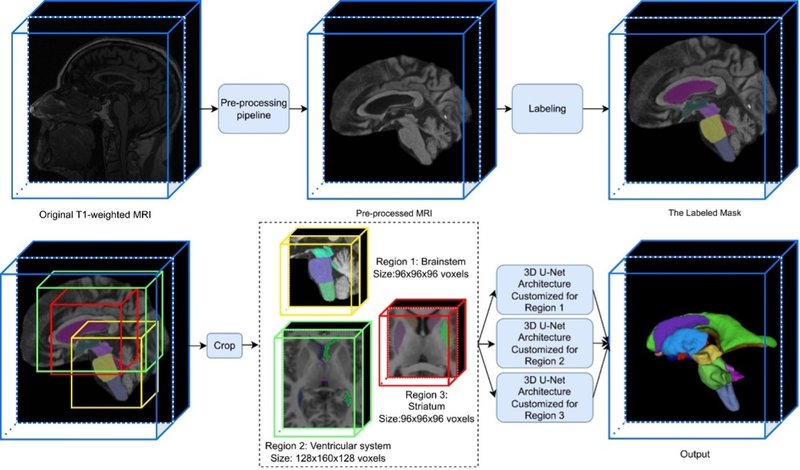 Myndin sýnir myndvinnsluaðferðina í heild, frá seguómmynd af höfði til merkinga á 12 heilasvæðum í 3-vídd. (Mynd frá Mengyu et al, NeuroImage:Clinical, 2025)
