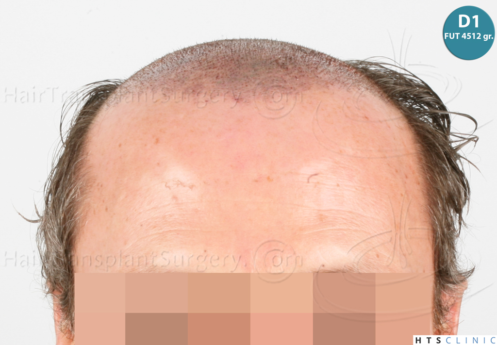 Dr.Devroye-Montesanti-Jenard-HTS-Clinic-