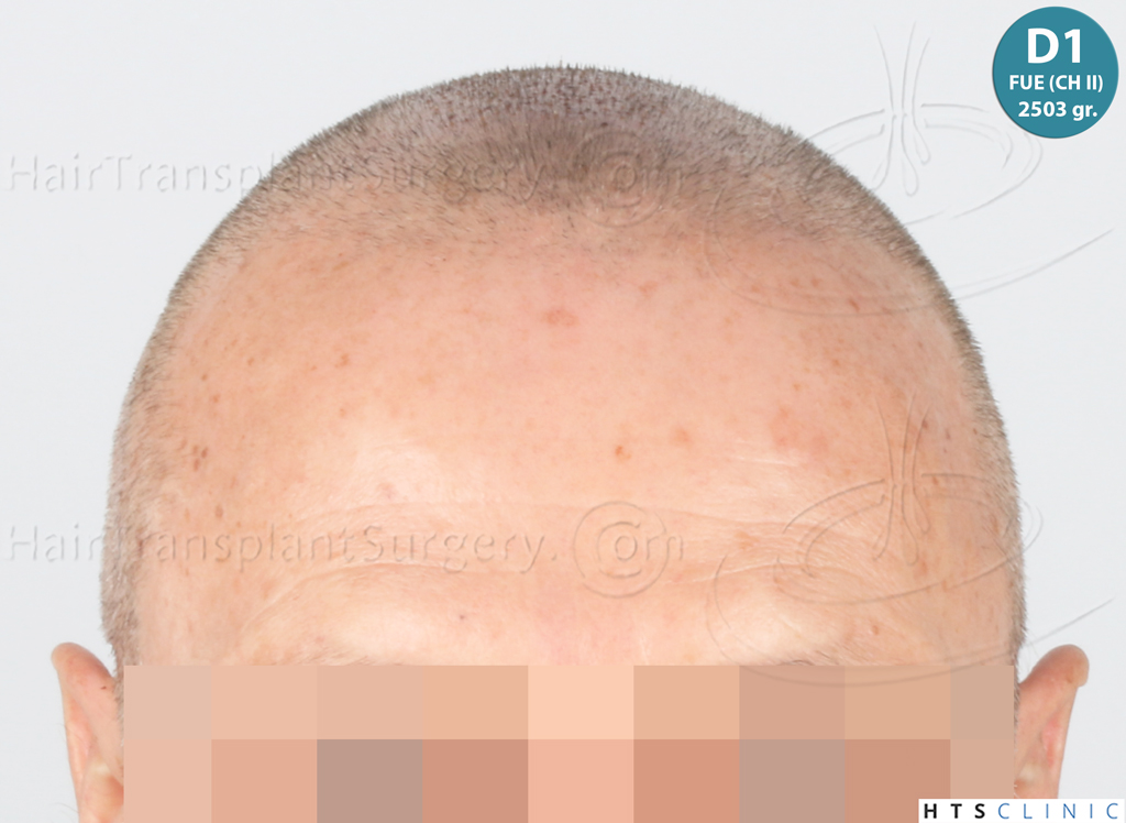 Dr.Devroye-Montesanti-Jenard-HTS-Clinic-