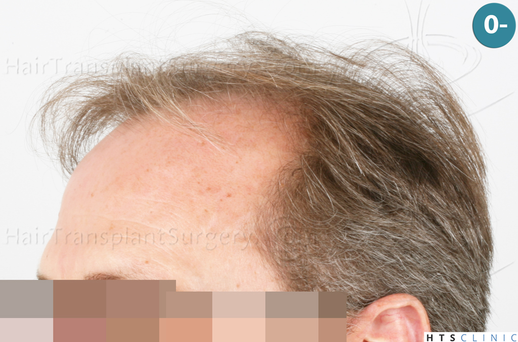 Dr.Devroye-Montesanti-Jenard-HTS-Clinic-