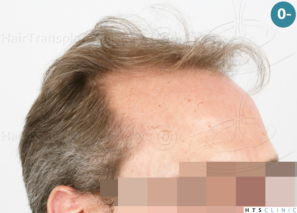 Dr.Devroye-Montesanti-Jenard-HTS-Clinic-