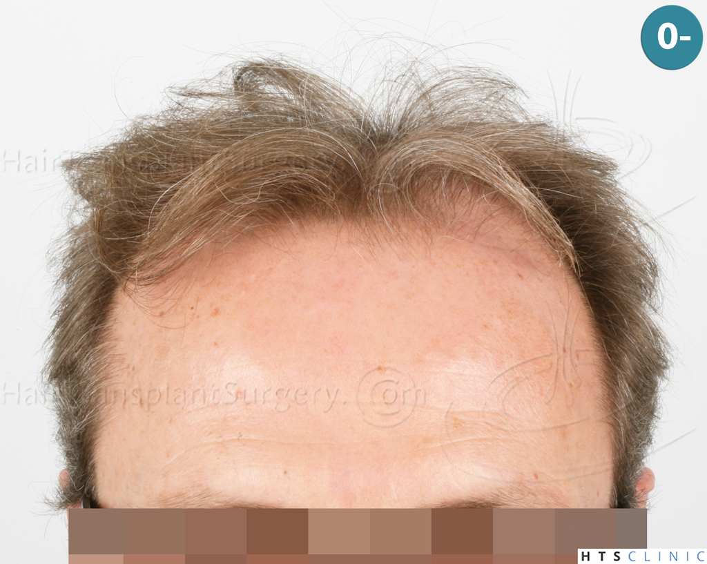 Dr.Devroye-Montesanti-Jenard-HTS-Clinic-