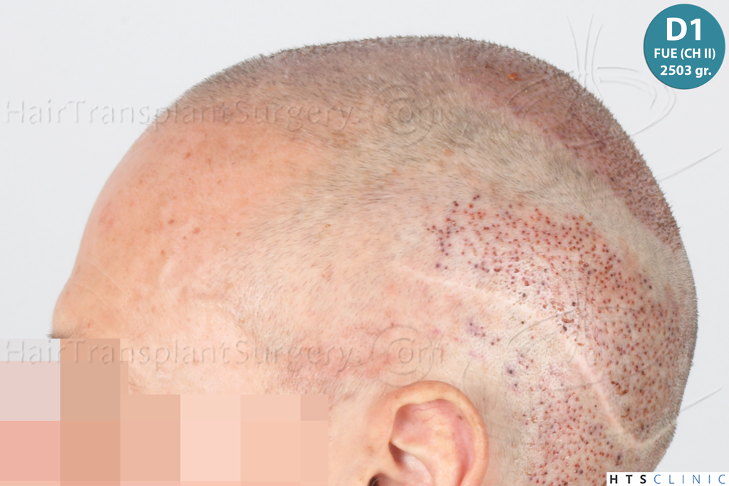 Dr.Devroye-Montesanti-Jenard-HTS-Clinic-