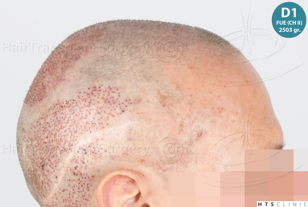 Dr.Devroye-Montesanti-Jenard-HTS-Clinic-